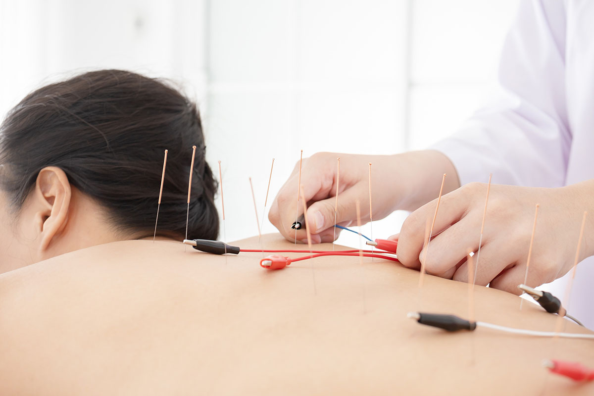 Close,Up,Woman,Undergoing,Acupuncture,Treatment,With,Electrical,Stimulation.
